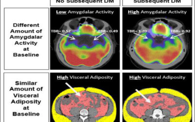 Emozioni e diabete: L’asse psiche-cervello-pancreas