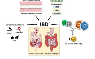 Come curare la malattia infiammatoria cronica intestinale in maniera integrata