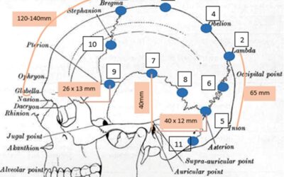 Emicrania, cefalea e suture craniche in ottica PNEI: perché usare terapie non farmacologiche come osteopatia e agopuntura
